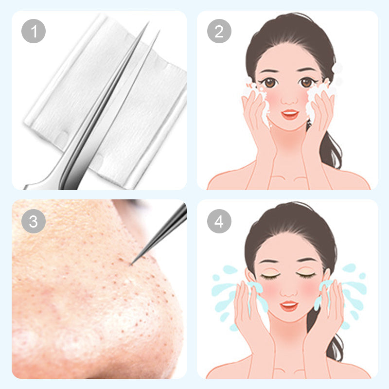 💓HEISSVERKAUF 50% RABATT💥Edelstahl-Schwarzenkopf-Entfernungs-Set (Alkoholpads kostenlos dazu)